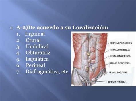 hernia inguinal código cie 10